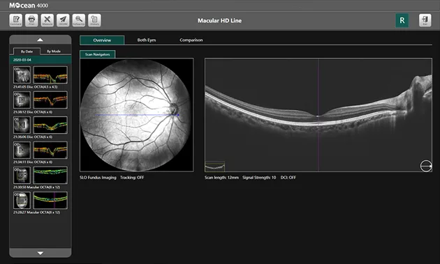 MOPTIM Mocean 4000 — Съёмка и разбор в одном интерфейсе — фото 3