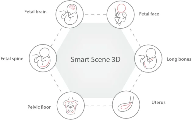 Mindray Imagyn I9 — Бесшумная работа