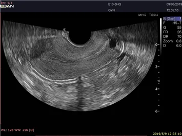 EDAN Acclarix LX9 — Клинические изображения Acclarix LX9 — фото 8