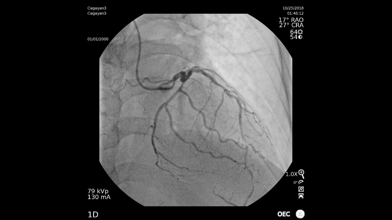 GE HealthCare OEC Elite CFD — Снимки, сделанные на OEC Elite — фото 3