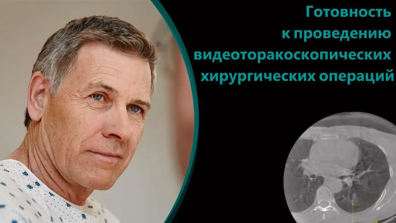 Siemens ARTIS pheno — Готовые сценарии сложных вмешательств — фото 5