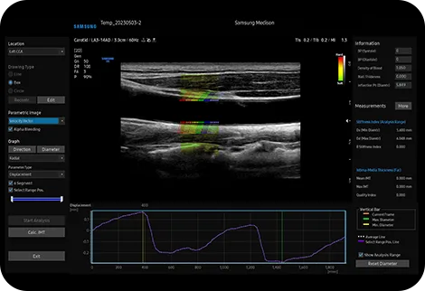 Samsung V6 — ArterialAnalysis: функция сосудов до морфологии