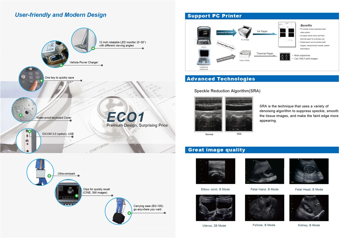 CHISON ECO 1 — Портатив, который носят в сумке