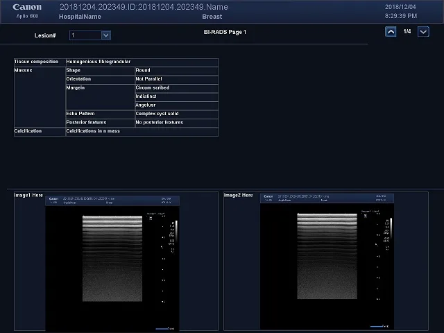 Canon Aplio i700 — BI-RADS и TI-RADS: описание по стандарту