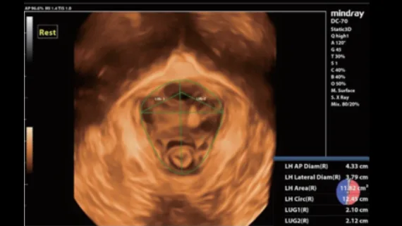 Mindray DC-70 Exp — Smart Pelvic: оценка тазового дна