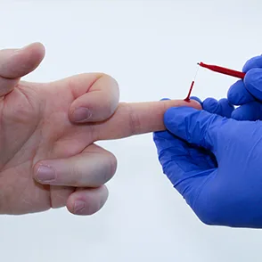 EKF Diagnostics Biosen C-Line GP+ — Три шага до результата