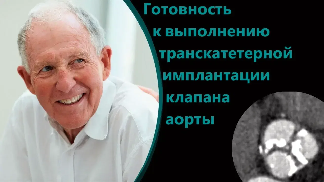 Siemens ARTIS pheno — Готовые сценарии сложных вмешательств — фото 4