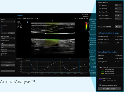 Samsung V8 — Сосуды: ArterialAnalysis и AutoIMT+