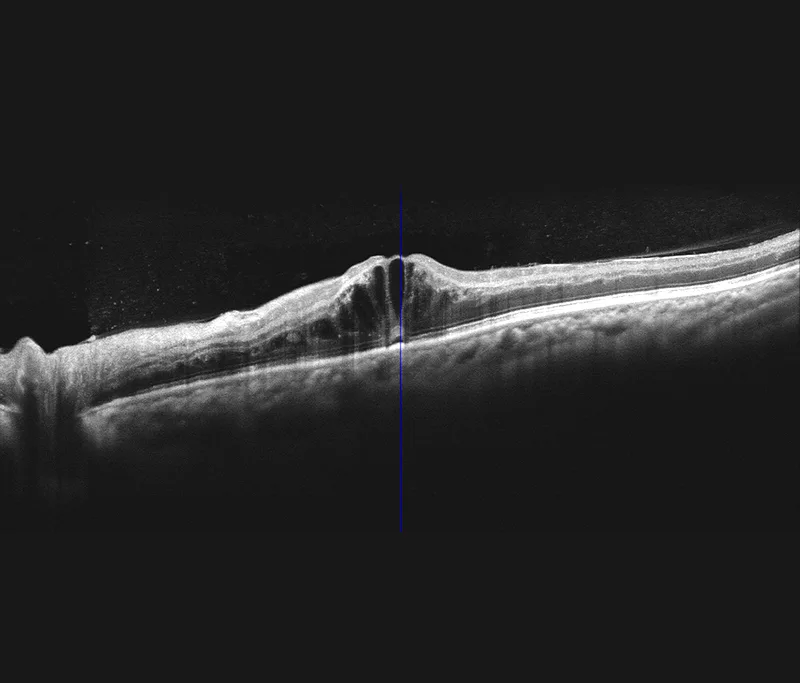 MOPTIM Mocean 4000 — Съёмка и разбор в одном интерфейсе — фото 4