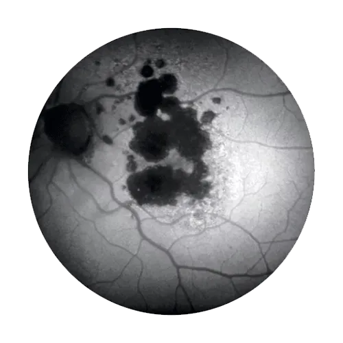 ZEISS VISUCAM 224 — Аутофлюоресценция в базовой комплектации