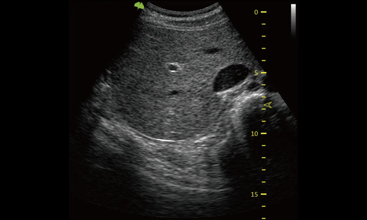 VINNO E35 — VFusion, VSpeckle и VTissue — фото 3
