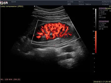 EDAN Acclarix LX9 — Клинические изображения Acclarix LX9 — фото 9