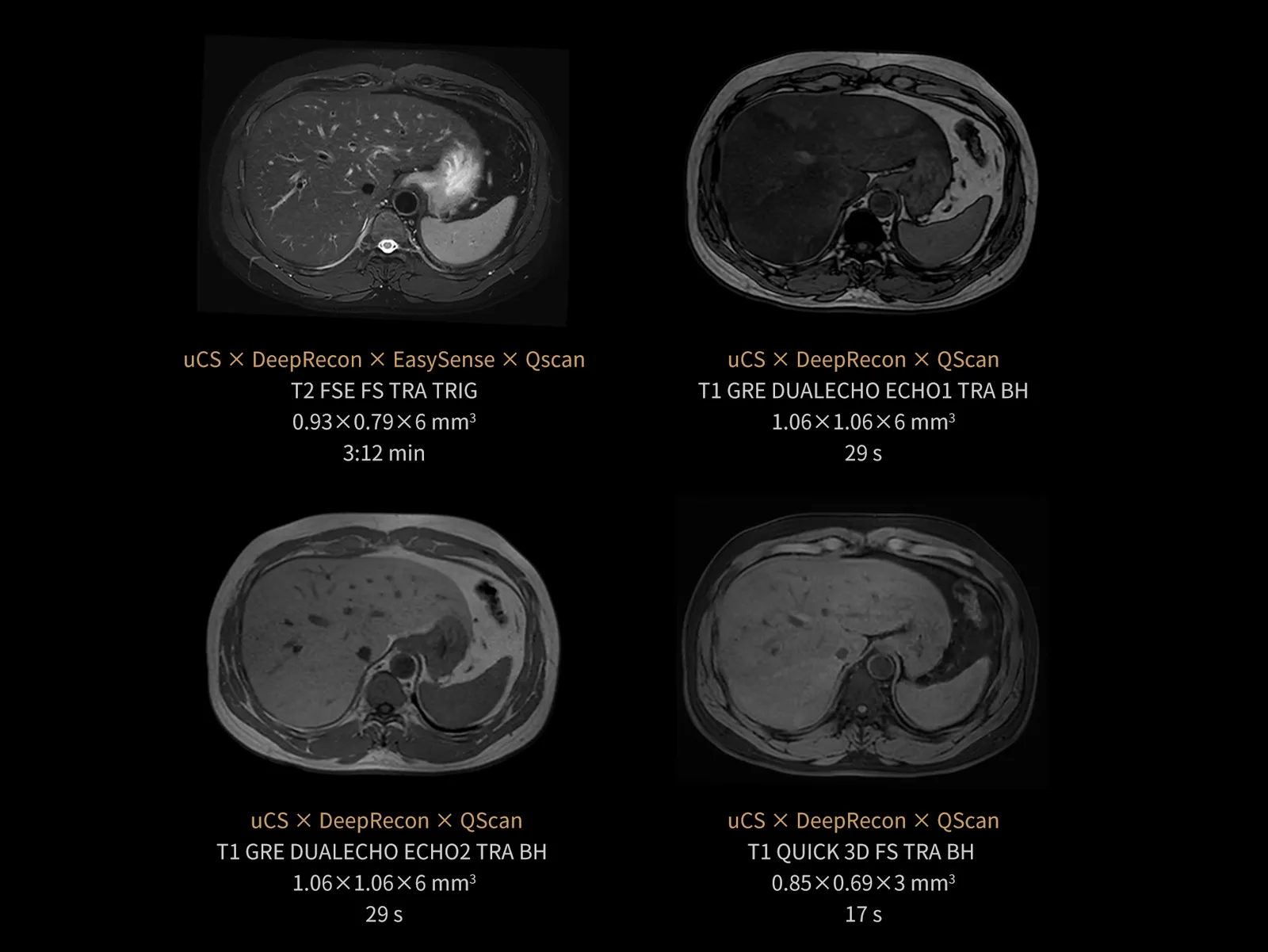 United Imaging uMR 670 1.5T — QScan: минус 97 % акустического шума