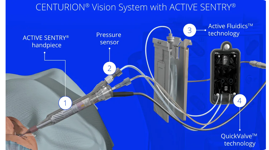 Alcon Centurion Vision System — Активная гидродинамика вместо штатива