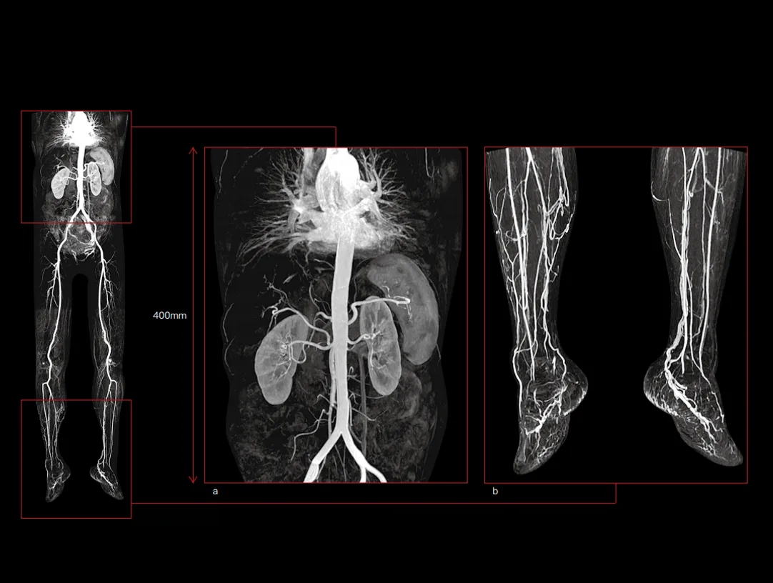 United Imaging uMR 780 — Клинические примеры — фото 3