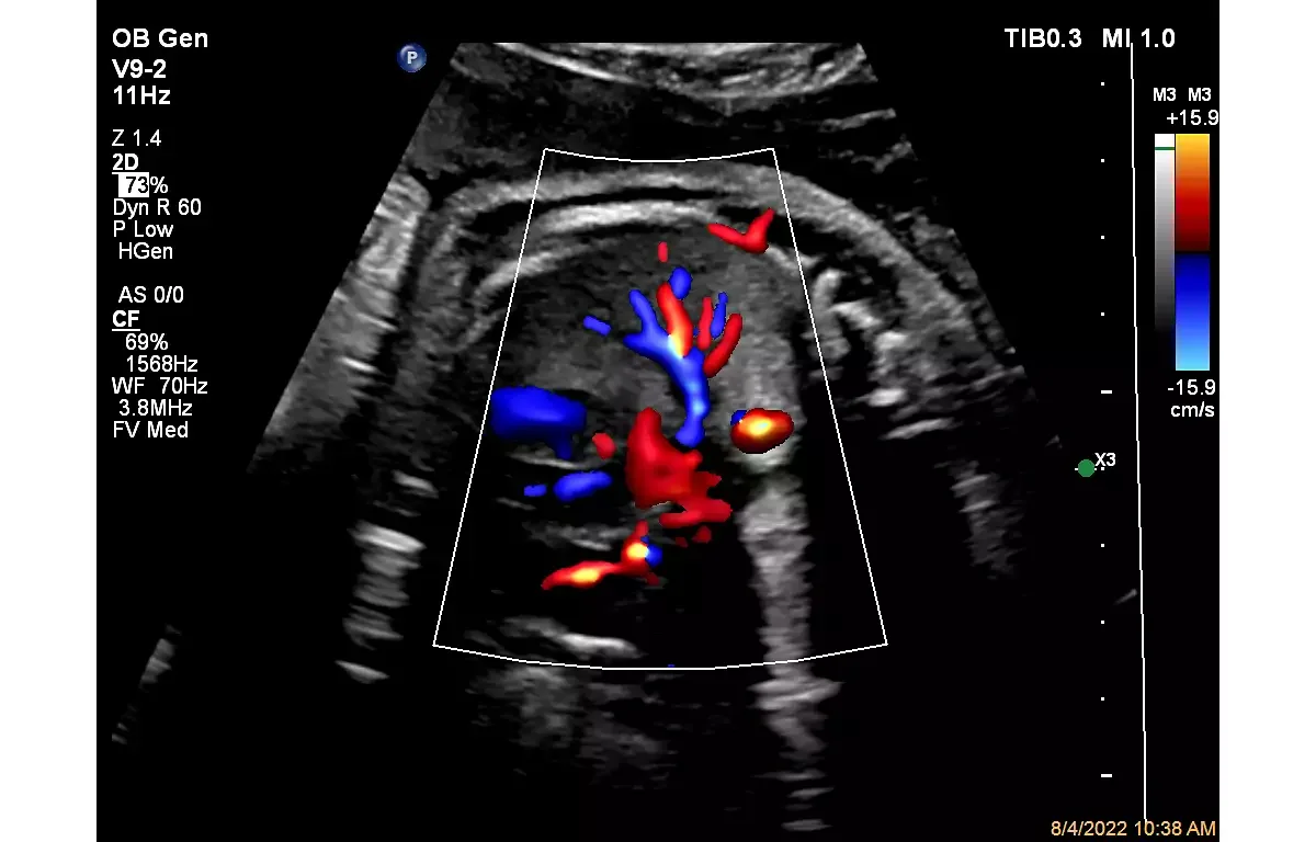 Philips Affiniti 50 — Клинические изображения Affiniti 50 — фото 8