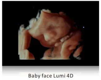 SIUI Apogee 5500 — Lumi 4D и nSlice: работа с объёмом