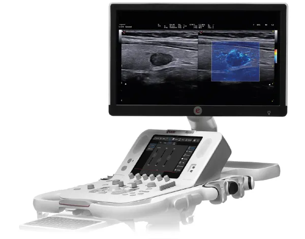 Esaote MyLab X8