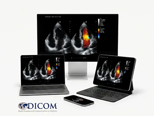 EVORAY USS 20 — DICOM 3.0 и передача исследований