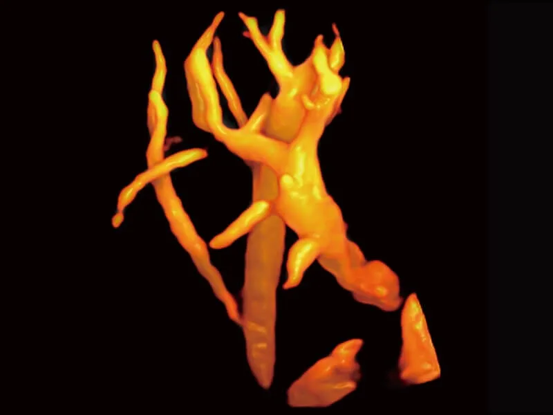SonoScape P40 Elite — Клинические изображения P40 Elite — фото 6