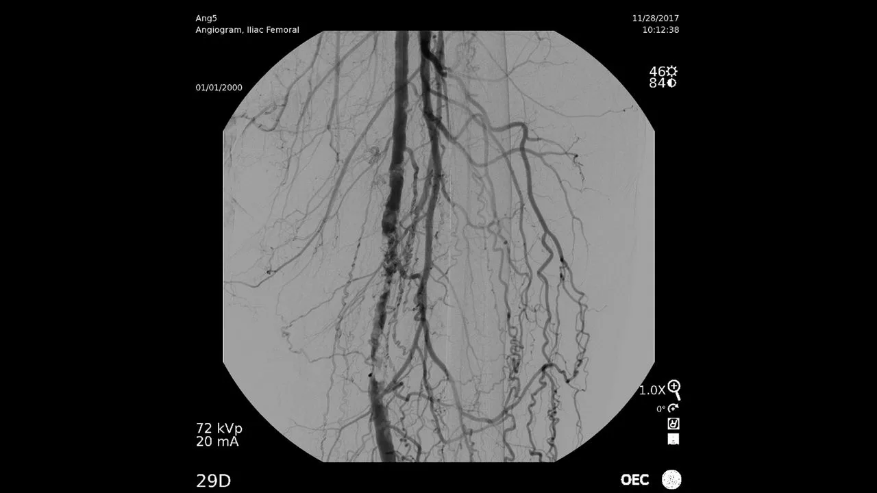 GE HealthCare OEC Elite CFD — Снимки, сделанные на OEC Elite — фото 4