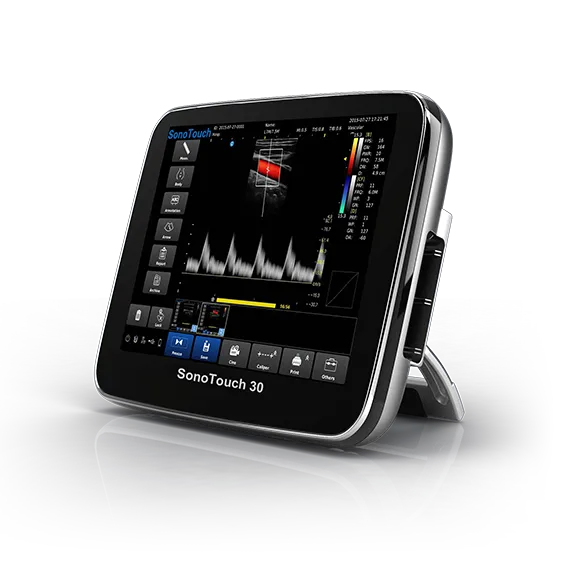 CHISON SonoTouch 30