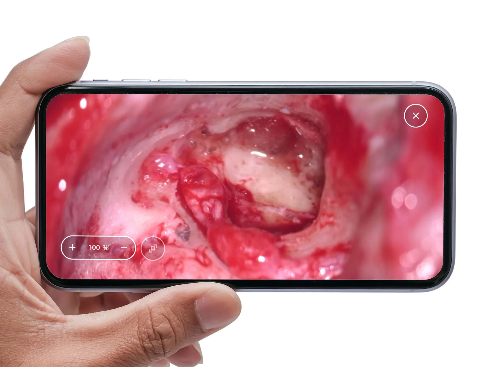 ZEISS TIVATO 700 — ИТ-контур: приложения, сеть, DICOM