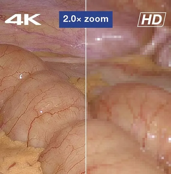 Olympus VISERA 4K UHD — Увеличение без развала картинки