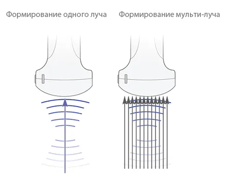 Mindray M9 — Формирование луча: мульти-луч и дополненный эхосигнал