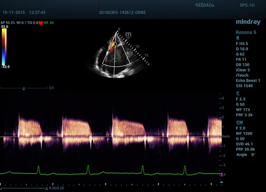 Mindray Resona 6 — Клинические изображения — фото 11