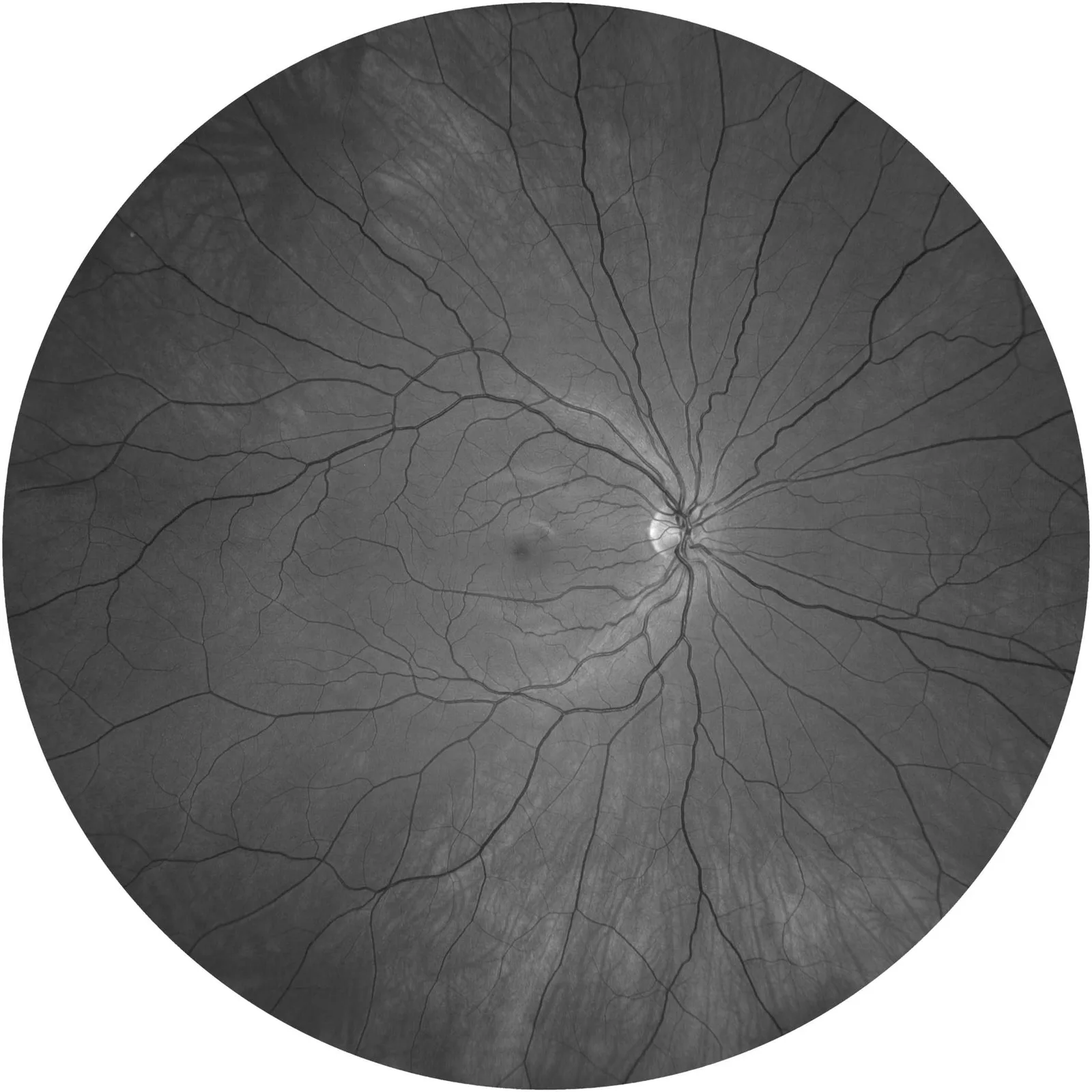 ZEISS CLARUS 700 — Три канала одного снимка