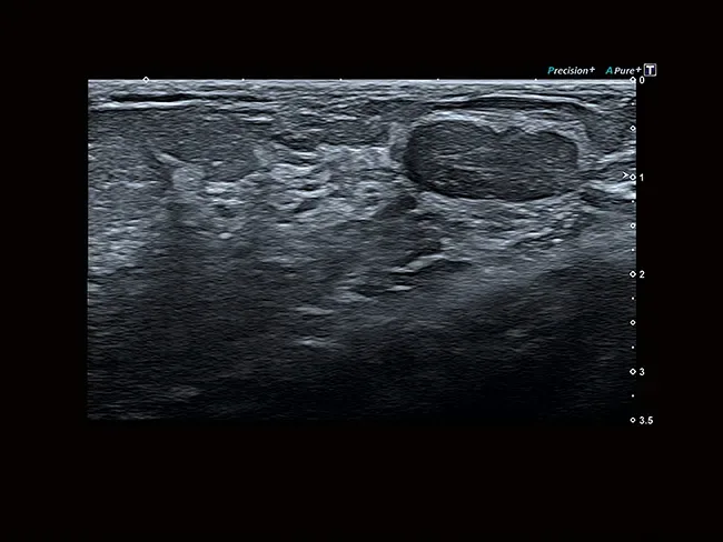 Canon Aplio a450 — Архитектура aBeam и качество изображения — фото 2