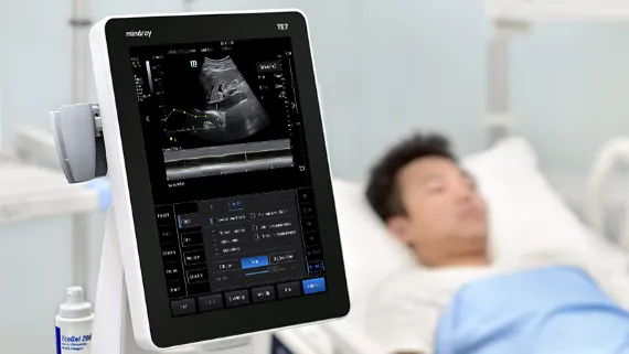 Mindray TE7 — Smart IVC — оценка волемического статуса
