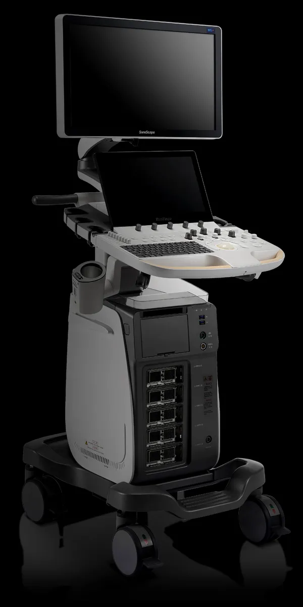SonoScape P60