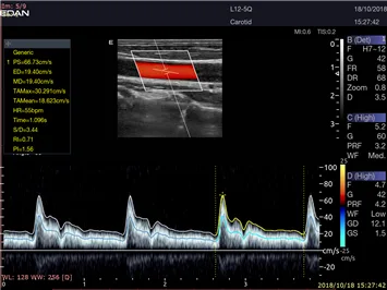 EDAN Acclarix LX9 — Клинические изображения Acclarix LX9 — фото 2