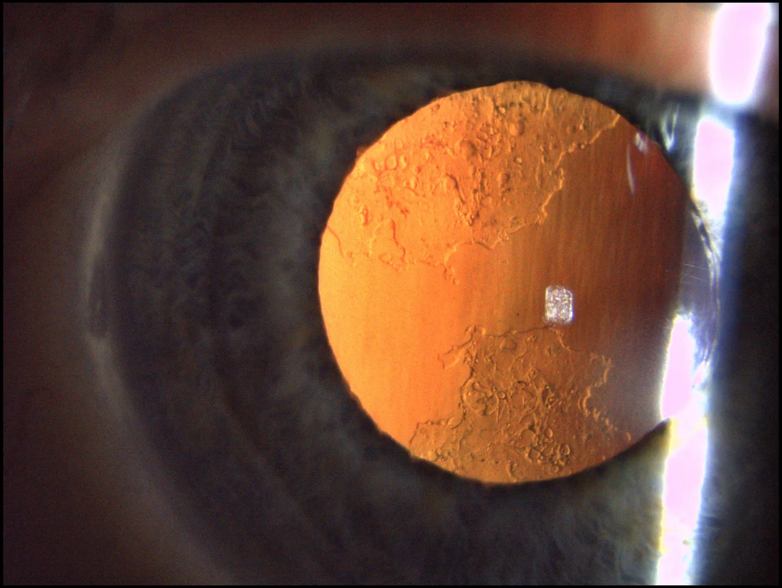 ZEISS SL 800 — Что видно на снимках с SL 800 — фото 2