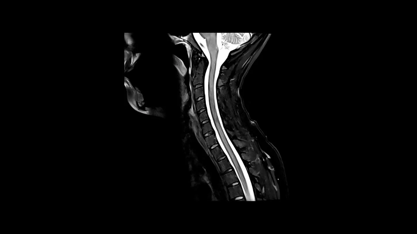 Siemens MAGNETOM Lumina 3T — BioMatrix Tuners: подстройка под пациента
