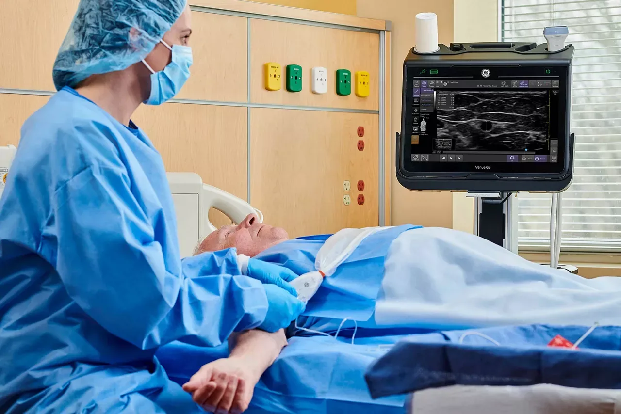 GE Venue Go — Catheter-to-Vessel Ratio: подбор катетера