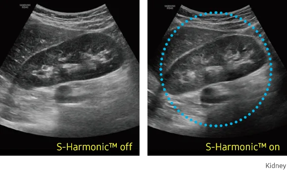 Samsung HS40 — S-Harmonic: ровная картинка по всей глубине