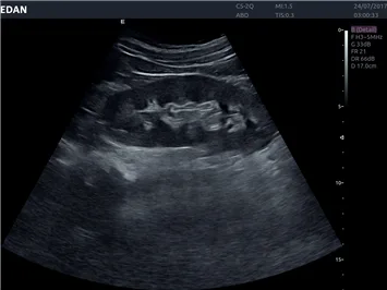EDAN Acclarix LX8 — Клинические изображения Acclarix LX8 — фото 8