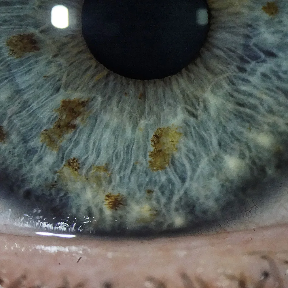 ZEISS SL 800 — TrueView Optics: пять ступеней увеличения 6–40× — фото 2