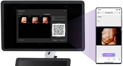 Samsung HS30 — HelloMom: снимки плода — родителям по QR-коду