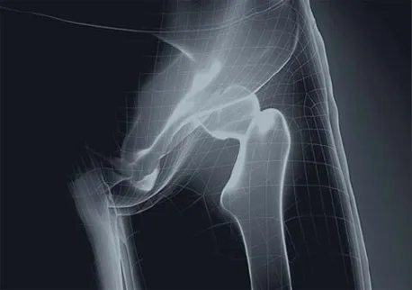 OsteoSys DEXXUM T — Позвоночник, оба бедра и предплечье
