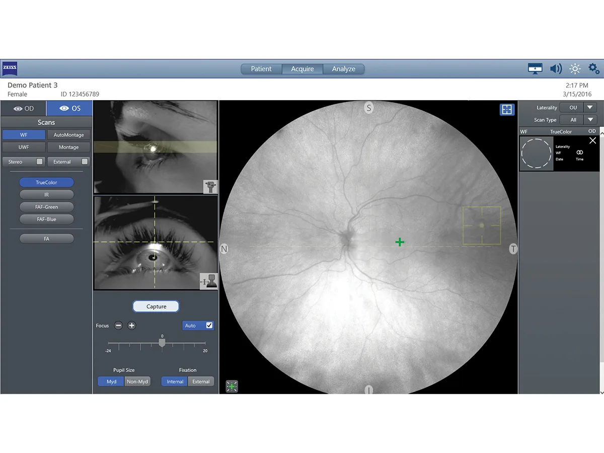 ZEISS CLARUS 700 — Автоматика, которая экономит время у прибора — фото 2
