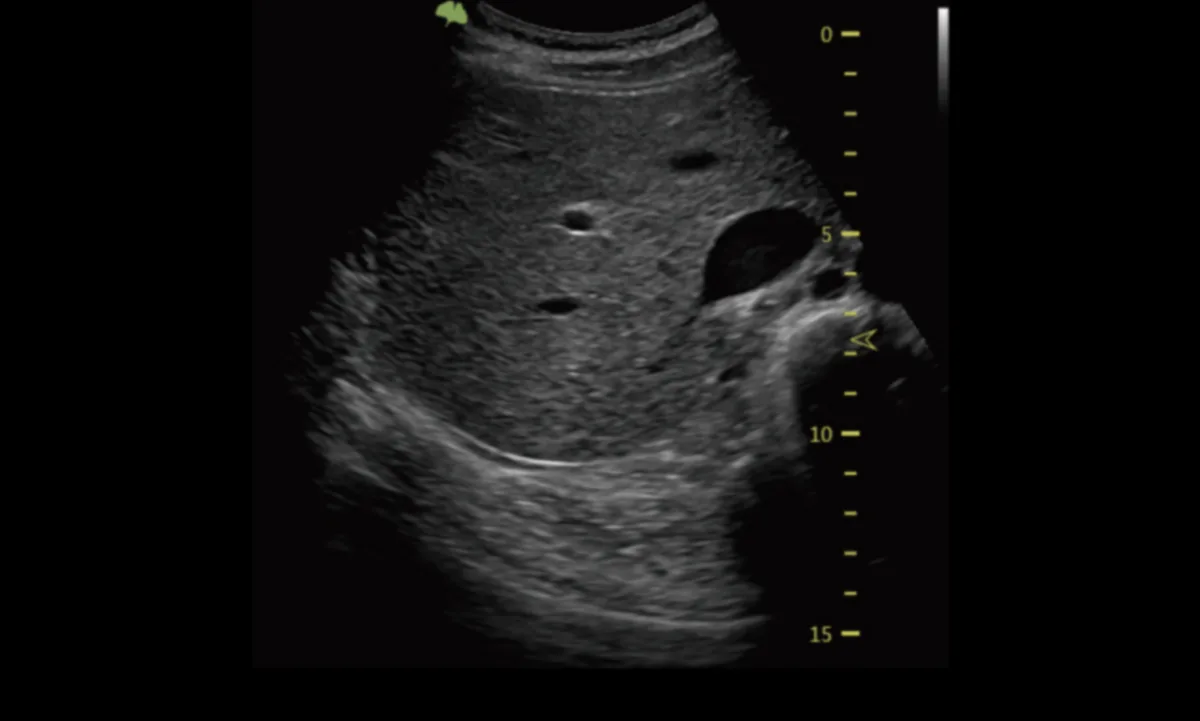 VINNO E35 — VFusion, VSpeckle и VTissue — фото 2