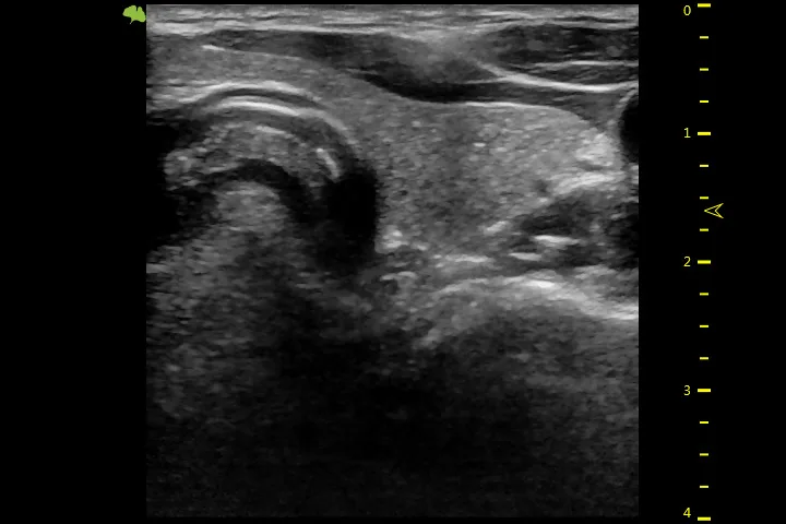 VINNO E35 — VFusion, VSpeckle и VTissue — фото 4