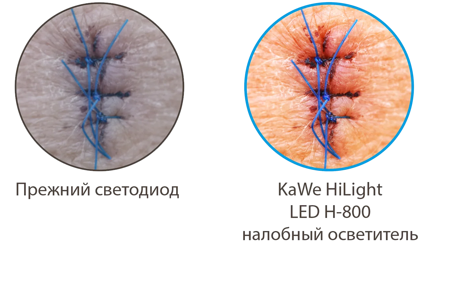 KaWe HiLight LED H-800 — Нейтральный белый свет и цветопередача CRI 93
