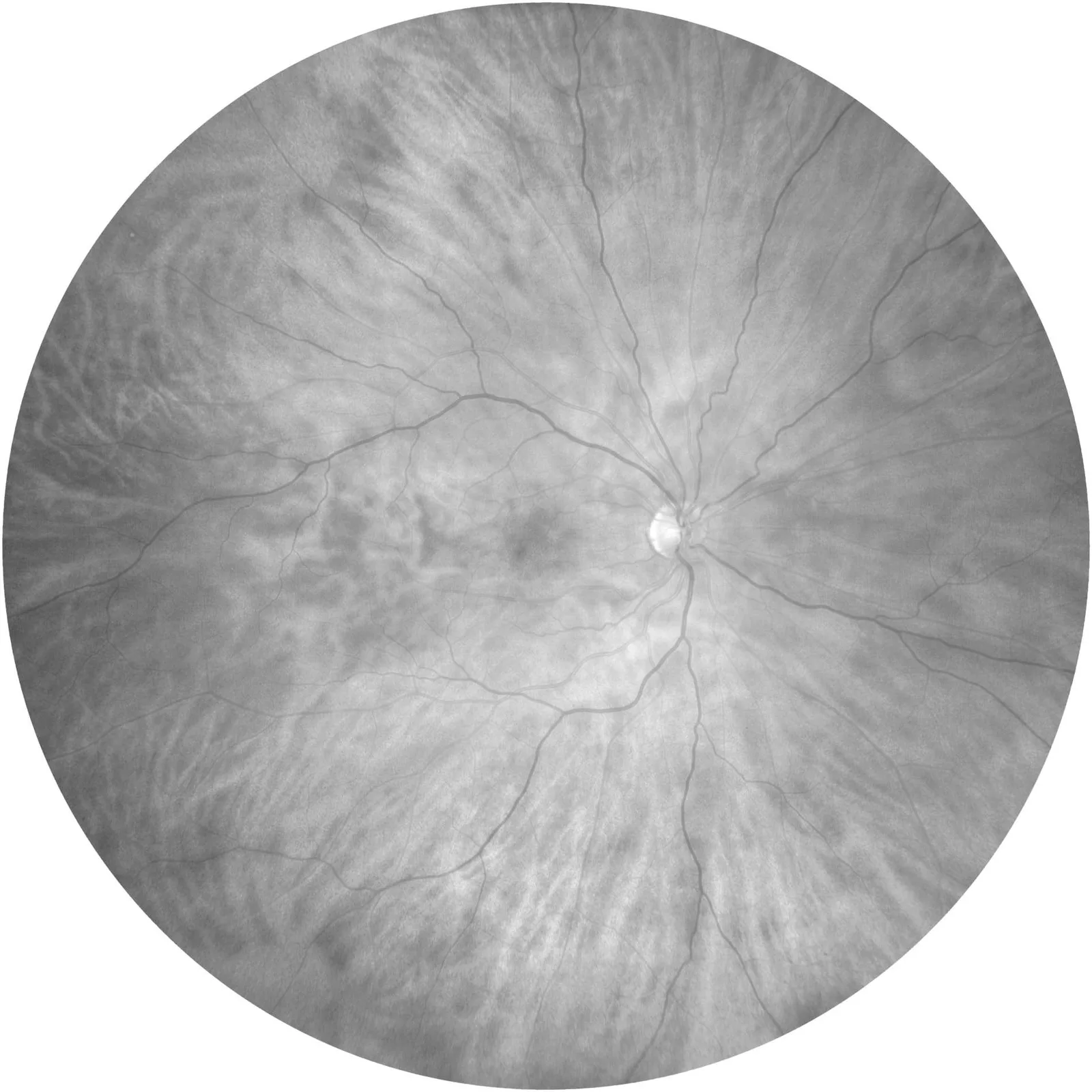 ZEISS CLARUS 700 — Три канала одного снимка