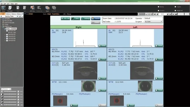 NIDEK AL-Scan — AL-Scan Viewer для NAVIS-EX