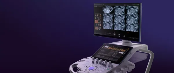 GE Voluson Signature 18